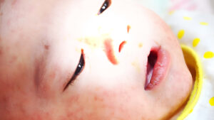 Niños muertos, niños gravemente enfermos: Pediatras hacen un conmovedor llamamiento por las vacunas