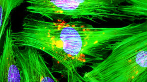 ¡Un Paso Adelante en la Reparación Cardíaca con Células Madre!