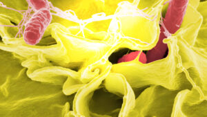 CDC Reduce el Monitoreo de Patógenos Alimentarios: Implicaciones para la Salud Pública